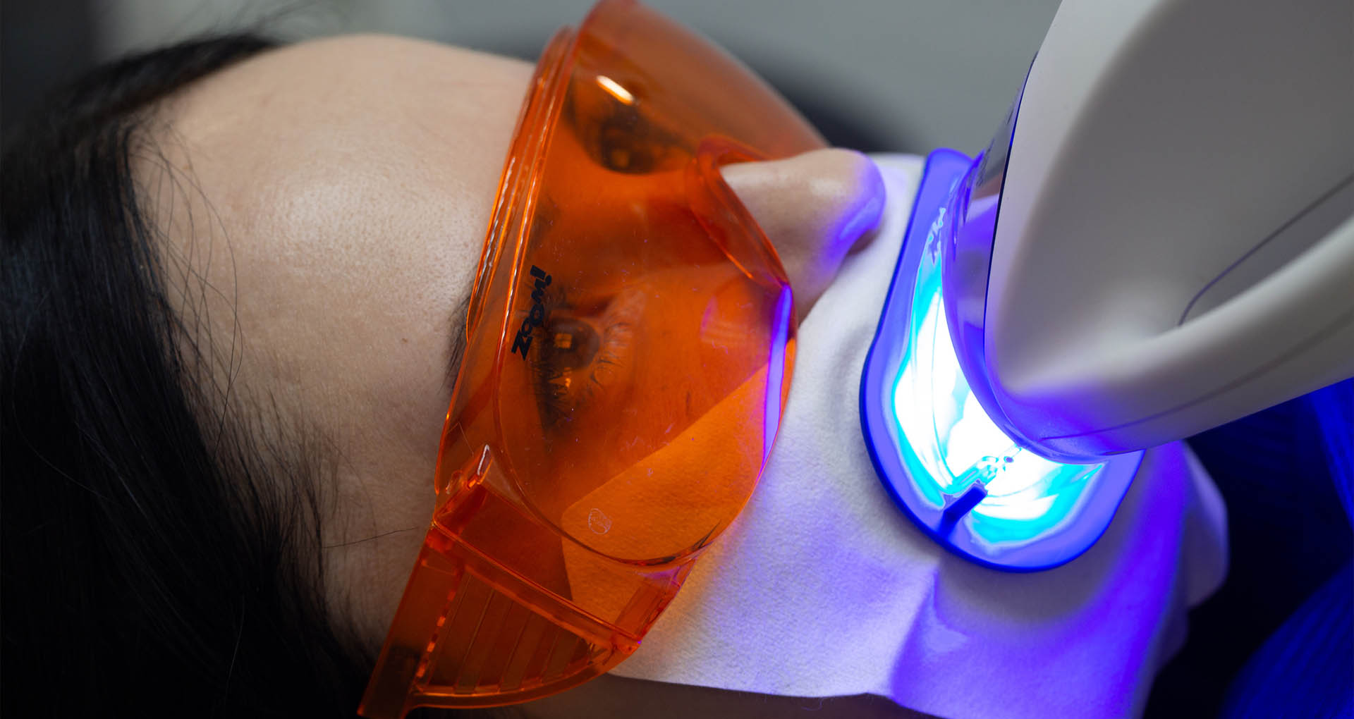 Blanqueamiento dental Blanqueamiento dental